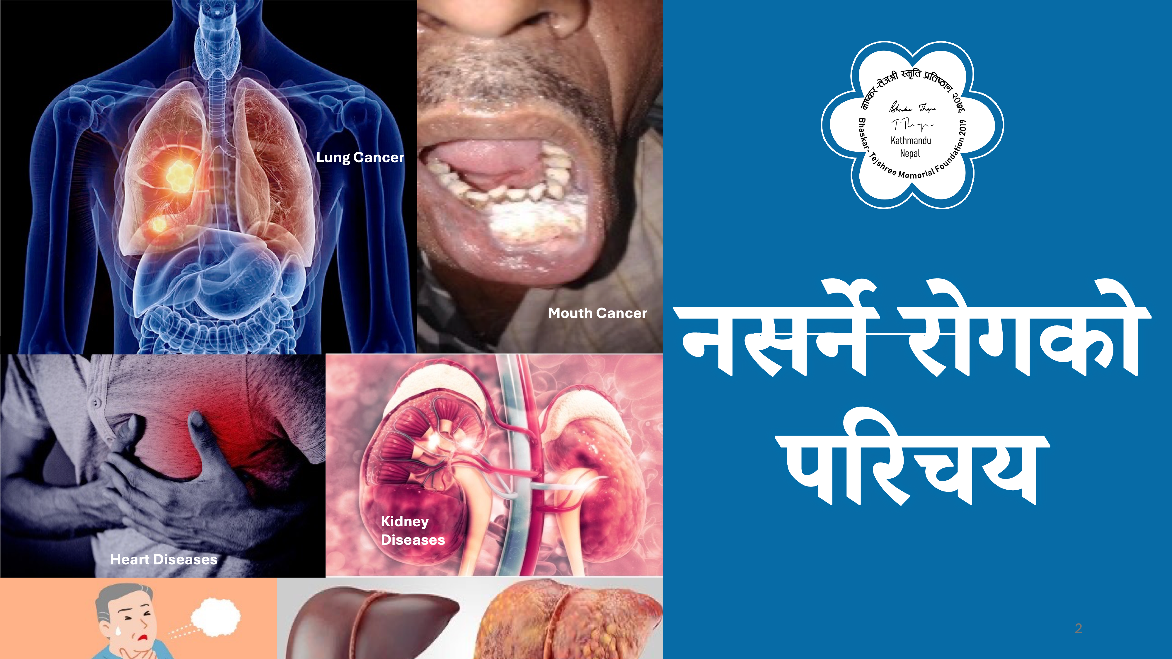 नसर्ने रोगको परिचय INTRO01